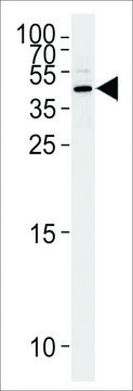 ANTI-MASPIN (CENTER) antibody produced in