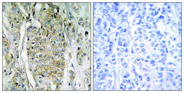 Anti-HER2 antibody produced in rabbit