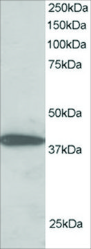 Anti-NIPP1/PPP1R8 antibody produced in goat