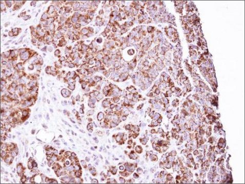 Anti-LRPPRC antibody produced in rabbit