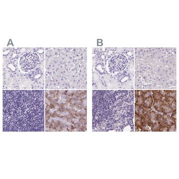 Anti-PDIA2 antibody produced in rabbit
