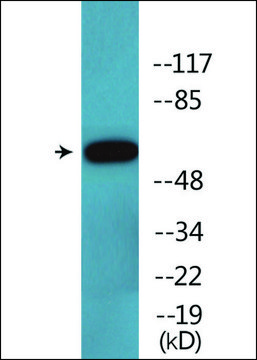 Anti-phospho-Cortactin (pTyr?²¹) antibody produced in