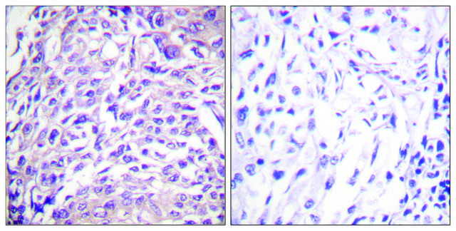 Anti-FOXO1A antibody produced in rabbit