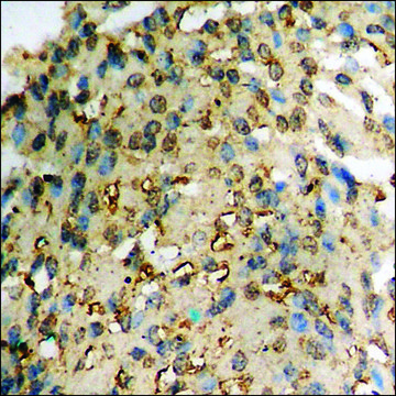 Anti-phospho-ICK (pTyr¹??) antibody produced in