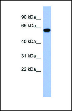 Anti-KLHL8, (N-terminal) antibody produced in