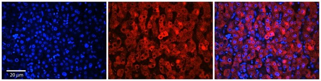 Anti-SLC37A4 antibody produced in rabbit