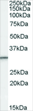 Anti-PSME1 (Isoform 1) antibody produced