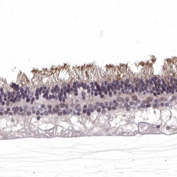 Anti-RGS9BP antibody produced in rabbit