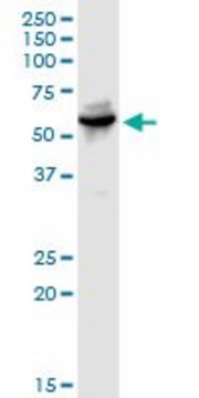 Anti-WARS antibody produced in rabbit