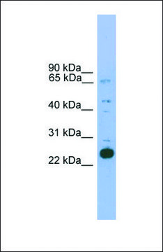 Anti-NKX2-6, (N-terminal) antibody produced in