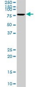 Anti-SLC6A4 antibody produced in rabbit