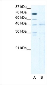 Anti-TBX5 antibody produced in rabbit