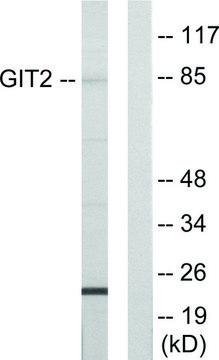 Anti-GIT2 antibody produced in rabbit