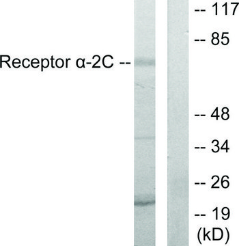 Anti-Adrenergic Receptor ?-2C antibody produced