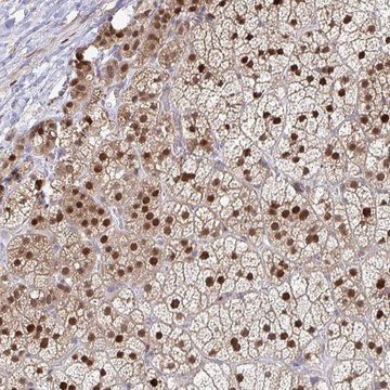 Anti-ACD antibody produced in rabbit