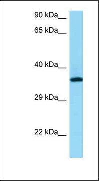 Anti-RGR antibody produced in rabbit