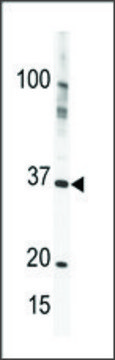 Anti-PRKY (C-term) antibody produced in