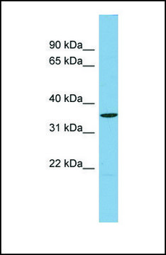 Anti-UCHL5 antibody produced in rabbit