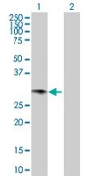 Anti-GCH1 antibody produced in rabbit