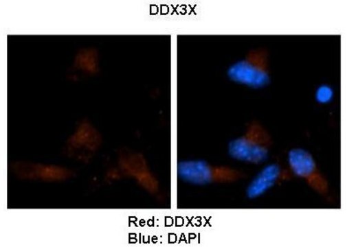 Anti-DDX3X, (N-terminal) antibody produced in