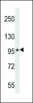ANTI-VSGP/F-SPONDIN(N-TERMINAL) antibody produced in rabbit