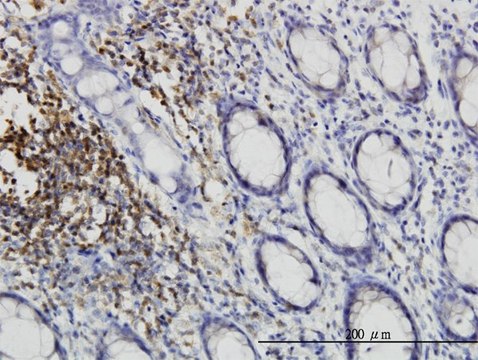 Monoclonal Anti-CSK antibody produced in