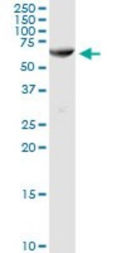Anti-AMY1C antibody produced in rabbit
