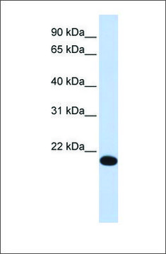 Anti-YAF2 antibody produced in rabbit