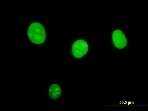 Monoclonal Anti-STK33 antibody produced in