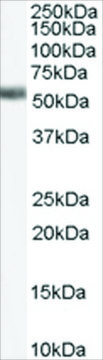 Anti-Farnesoid X Receptor/HRR1 antibody produced