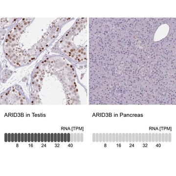 Anti-ARID3B antibody produced in rabbit