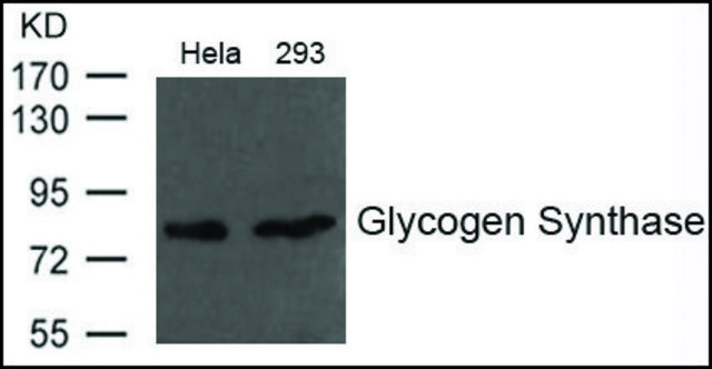 Anti-Glycogen Synthase antibody produced in
