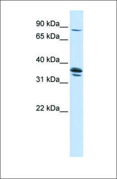 Anti-SLCO3A1 antibody produced in rabbit