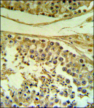 ANTI-CLRN1 (C-TERM) antibody produced in