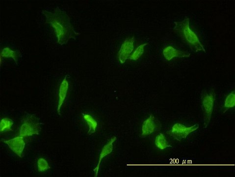 Monoclonal Anti-GLMN antibody produced in