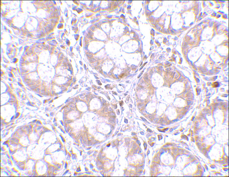 Anti-TEM2 antibody produced in rabbit
