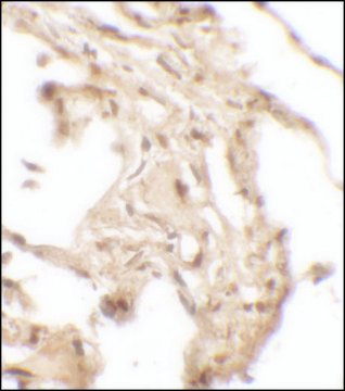 Anti-WFDC2 antibody produced in rabbit