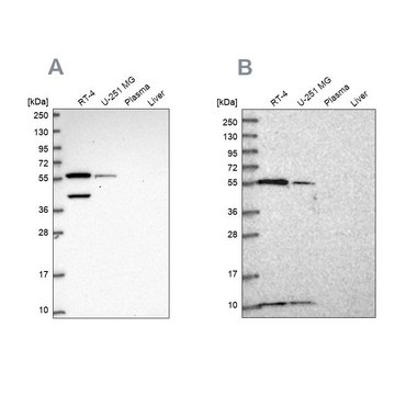 Anti-NUP50 antibody produced in rabbit