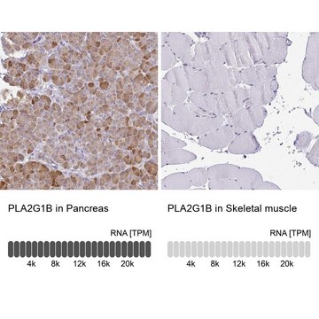 Anti-PLA2G1B antibody produced in rabbit