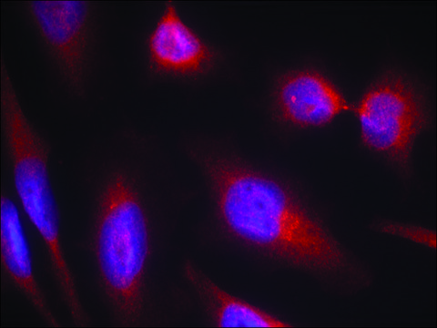 Anti-MAPT (Ab-214) antibody produced in