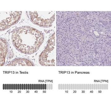 Anti-TRIP13 antibody produced in rabbit