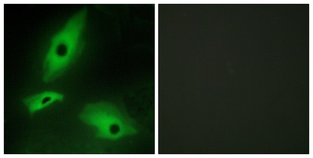 Anti-LTBR antibody produced in rabbit