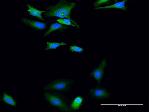 Anti-UGP2 antibody produced in rabbit
