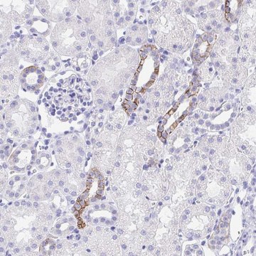 Anti-MON1A antibody produced in rabbit
