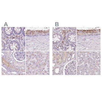 Anti-HEXB antibody produced in rabbit