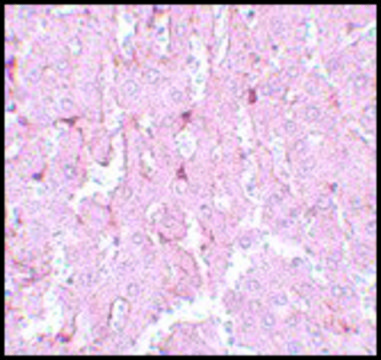 Anti-LXR-A antibody produced in rabbit