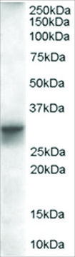 Anti-SLIMMER/FHL1 Isoform B antibody produced