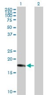 Anti-CENPM antibody produced in rabbit