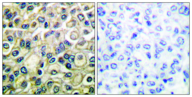 Anti-Claudin 1 antibody produced in