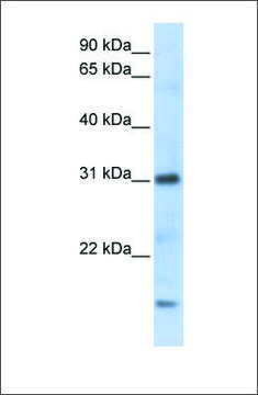 Anti-CXCL16 antibody produced in rabbit